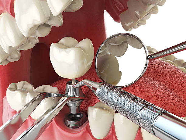 Best Holiday Emergency Dentist in Colonial Heights, VA